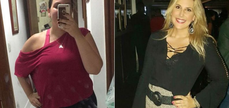 1ª mulher a reduzir estômago sem cortes na barriga conta como está, 4 meses depois